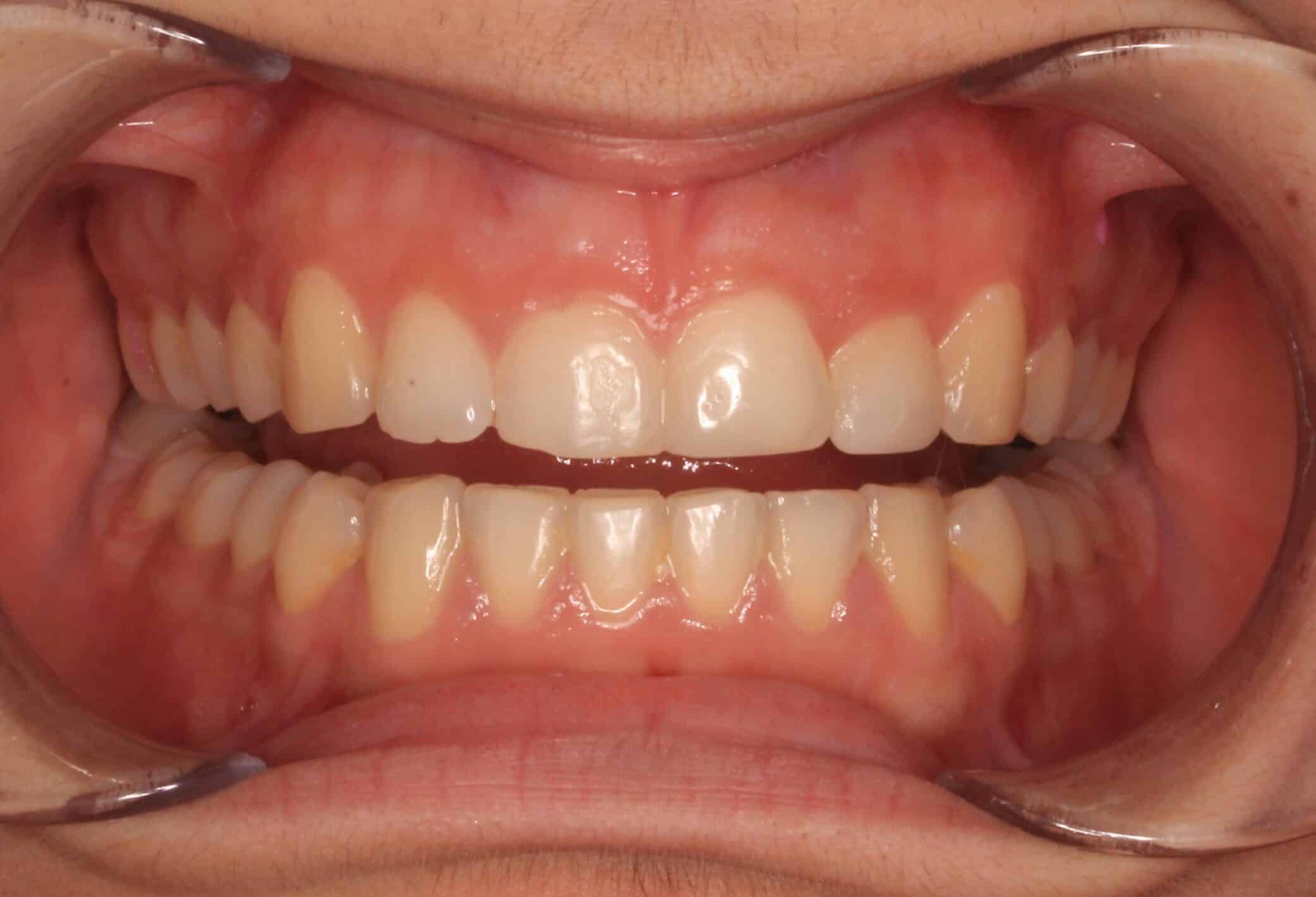 differ_before_image