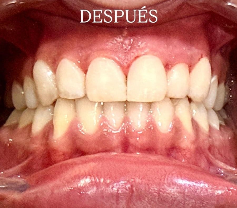 differ_before_image